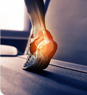 Pourquoi vos chaussures ne suffisent pas à protéger vos pieds (et ce que vous pouvez faire) - MyMiivo