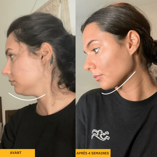 MIVO Brosse Lymphatique — Dégonfle, Sculpte Et Redéfinis En 3 Minutes - MyMiivo